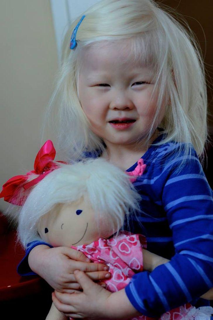 Μια μαμά φτιάχνει κούκλες που μοιάζουν με παιδιά με αναπηρία για να τιμήσει την διαφορετικότητα!