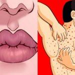 Άγχος: Τα 8 ψυχοσωματικά προβλήματα που δείχνουν ότι σε κυριεύει & πως να το αντιμετωπίσεις