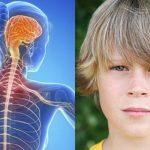 Σκλήρυνση κατά πλάκας στα παιδιά & στους εφήβους: Τα συμπτώματα