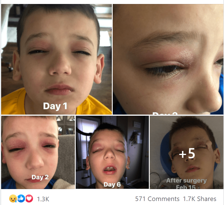 Τα κόκκινα σημάδια στα παιδιά μπορεί να δείχνουν στρεπτόκοκκο Τα κόκκινα σημάδια στα παιδιά μπορεί να δείχνουν στρεπτόκοκκο