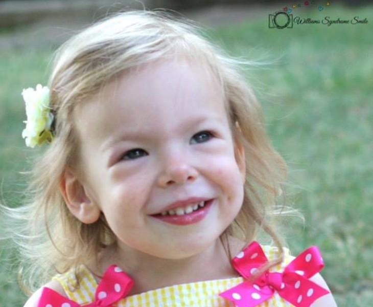 παιδί με Σύνδρομο Γουίλιαμς