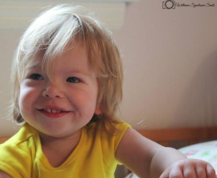 παιδί με σύνδρομο Williams 