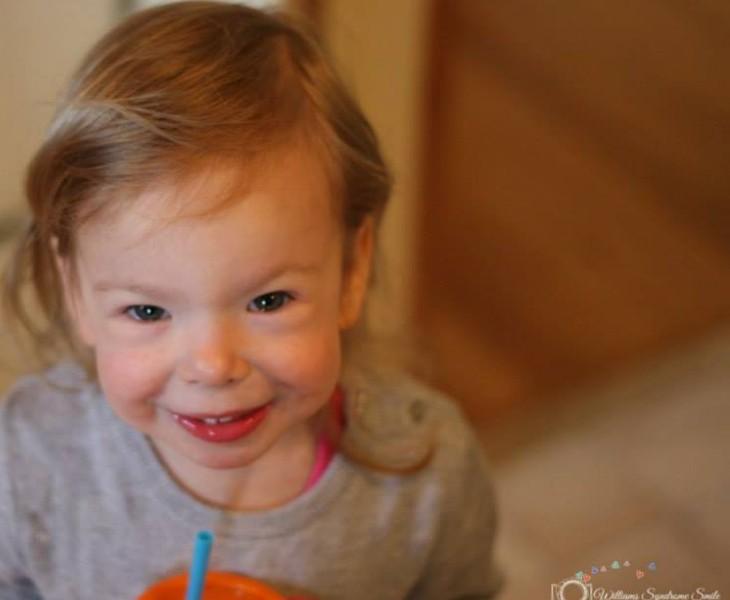 παιδί με σύνδρομο Williams 