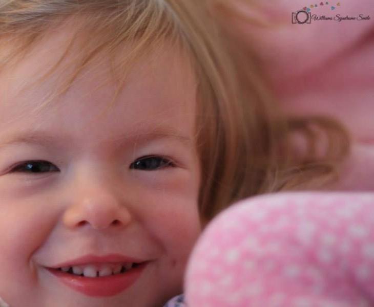 παιδί με σύνδρομο Williams 