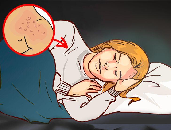 Οι ζεστές πιτζάμες μπορεί να σου προκαλέσουν σπυράκια