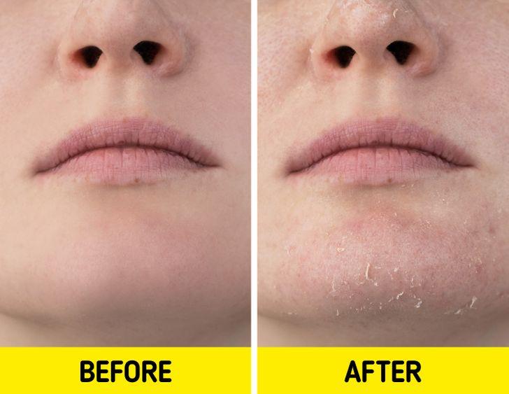 Οι ζεστές πιτζάμες μπορεί να προκαλέσουν λοιμώξεις