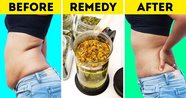 Βάλσαμο λεμονιού για την απώλεια βάρους Βάλσαμο λεμονιού για την απώλεια βάρους