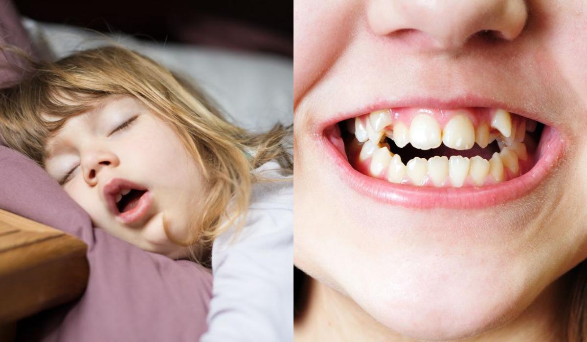 Τα 3 προβλήματα υγείας που μπορεί να έχει το παιδί αν κοιμάται με το στόμα ανοιχτό