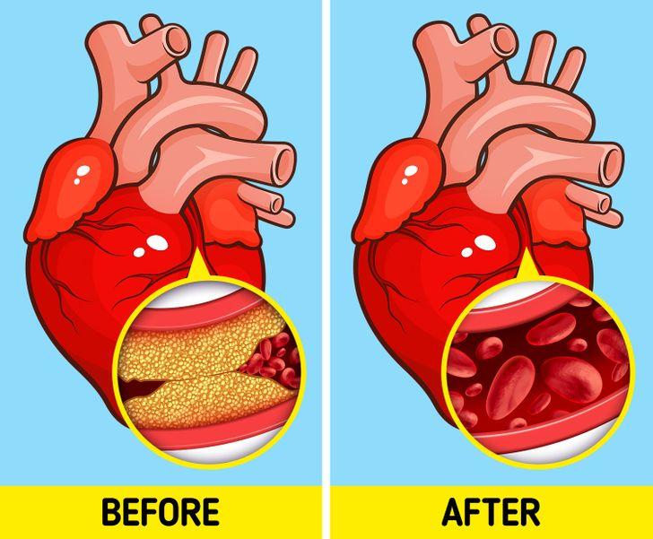 Η σοκολάτα για πρωινό κάνει καλό γενικά, στην υγεία_ Η σοκολάτα για πρωινό κάνει καλό στην υγεία_