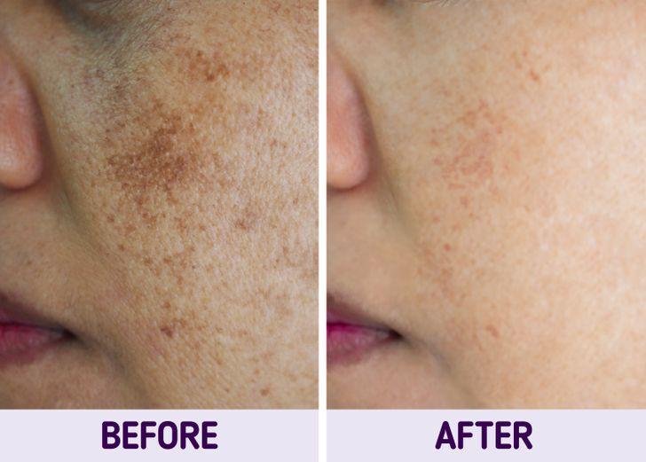 Καταναλώστε_ amla _μετά το_ γεύμα σας_