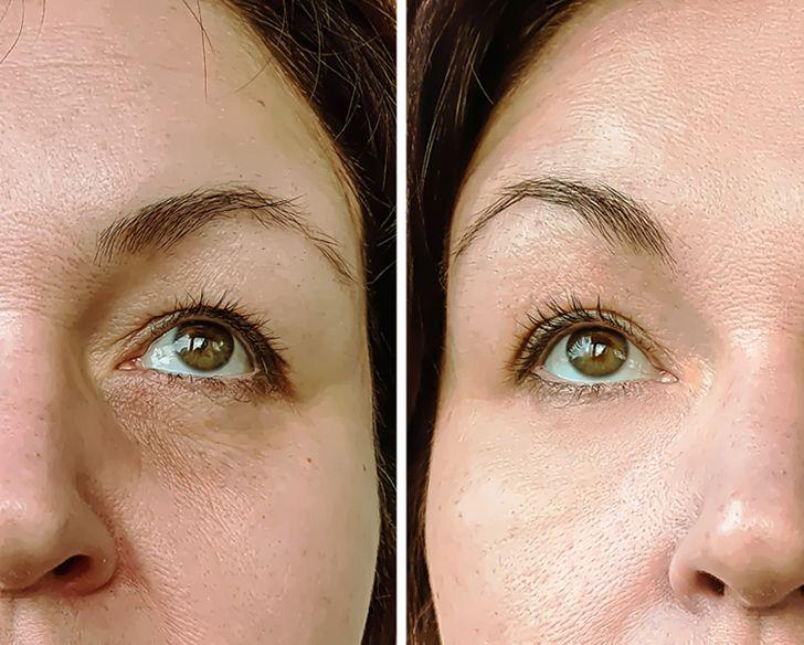 1 κουταλιά ελαιόλαδο κάθε πρωί μεταμορφώνει το δέρμα σας_ 1 κουταλιάελαιόλαδο κάθε πρωί μεταμορφώνει το δέρμα σας_