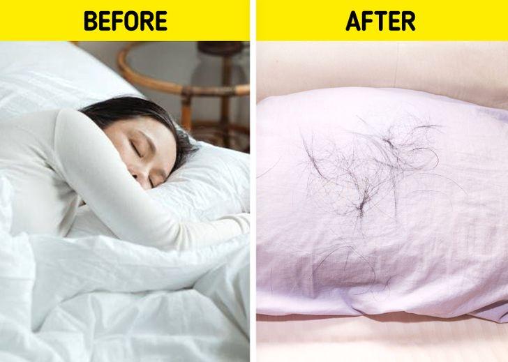 πολλά_μαλλιά_στο_μαξιλάρι_κάθε_πρωί_ πολλά_μαλλιά_στο_μαξιλάρι_κάθε_πρωί_