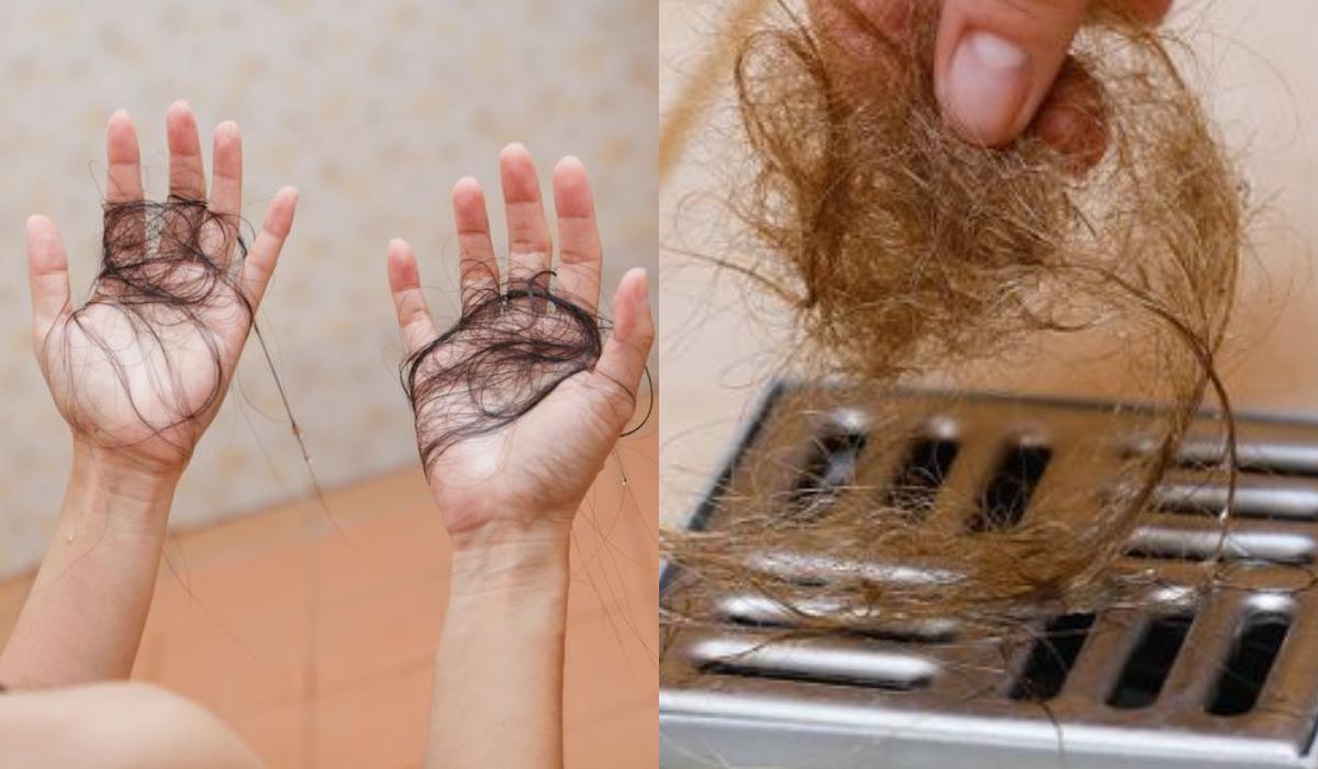 Έντονη τριχόπτωση : Δειτε 7 τρόπους για να το διαπιστώσετε_