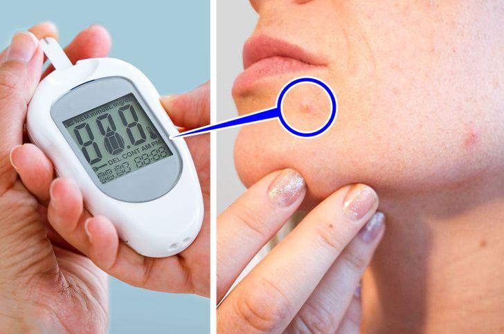 ο_καφές_ανεβάζει_το_σάκχαρο_ ο_καφές_ανεβάζει_το_σάκχαρο_