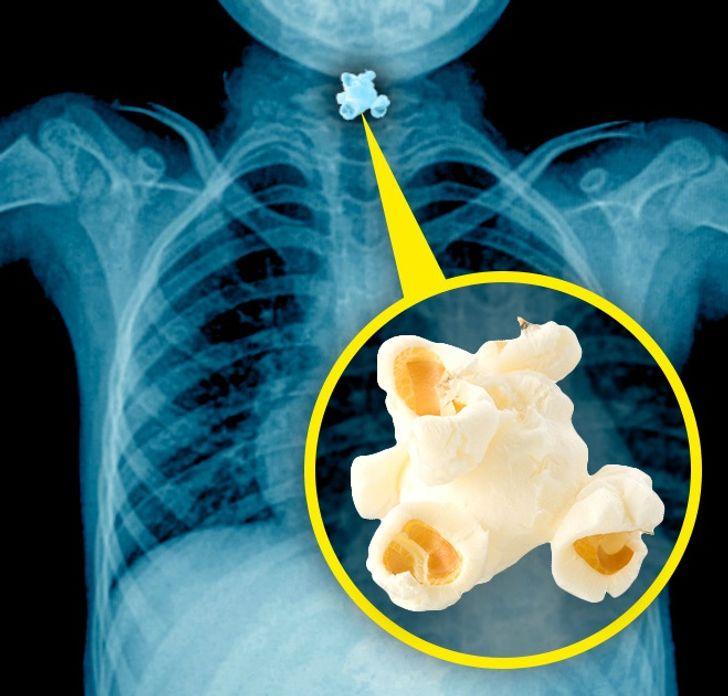 γιατί_τα_παιδιά_κάτω_των_4 ετών_δεν_πρέπει_να_τρώνε_ποπ κορν_