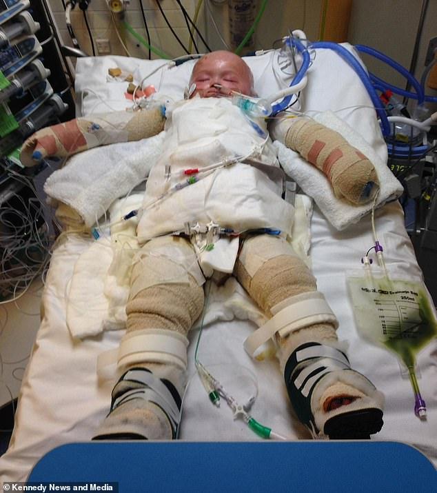 μαμά προειδοποιεί_το_παιδί_έπεσε_σε_καυτό_νερό_παιδικό ατύχημα_ μαμά προειδοποιεί_το_παιδί_έπεσε_σε_καυτό_νερό_παιδικό ατύχημα_