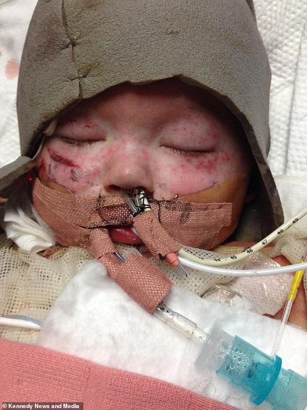 μαμά προειδοποιεί_το_παιδί_έπεσε_σε_καυτό_νερό_παιδικό ατύχημα_ μαμά προειδοποιεί_το_παιδί_έπεσε_σε_καυτό_νερό_παιδικό ατύχημα_