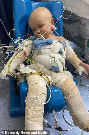 μαμά προειδοποιεί_το_παιδί_έπεσε_σε_καυτό_νερό_παιδικό ατύχημα_ μαμά προειδοποιεί_το_παιδί_έπεσε_σε_καυτό_νερό_παιδικό ατύχημα_