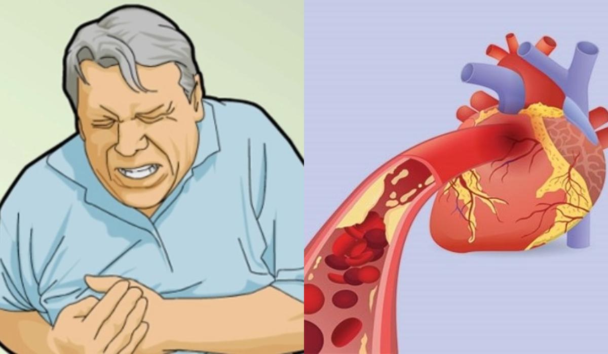 Ανακοπή καρδιάς: 6 συμπτώματα που θα νιώσετε μερικές μέρες πριν_