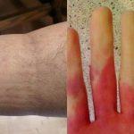 Ανακοπή καρδιάς: 6 συμπτώματα που θα νιώσετε μερικές μέρες πριν