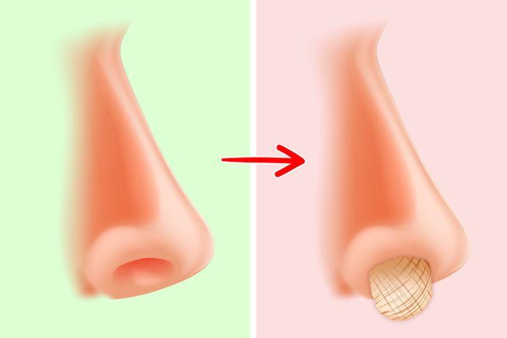 το σκάλισμα_της_μύτης_μπορεί_να_κάνει_την_μύτη_μας_να_ματώσει_