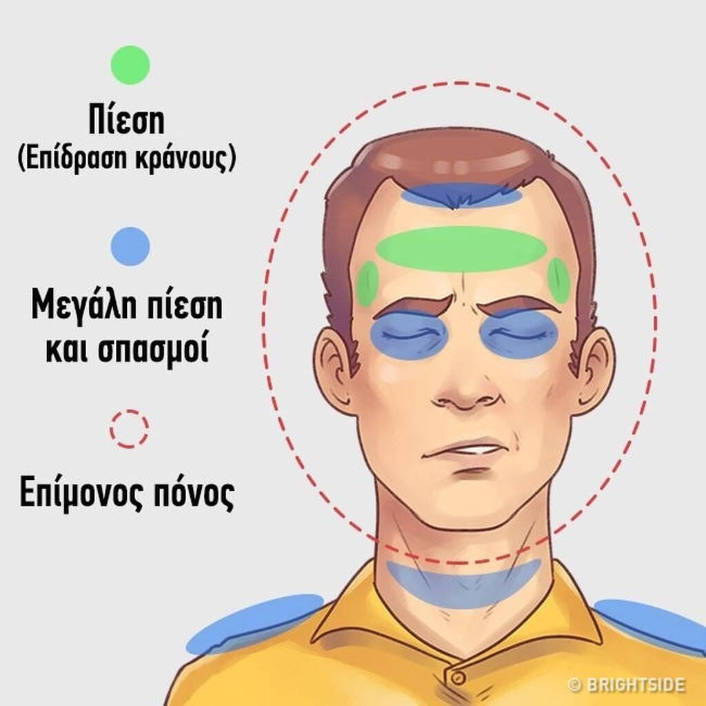 πονοκέφαλος_5_είδη_πονοκεφάλου_