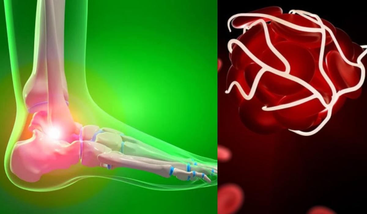 πρησμένοι_αστράγαλοι_9_πιθανές_αιτίες_και_πότε_πρέπει_να_κλείσουμε_ραντεβού_με_γιατρό_