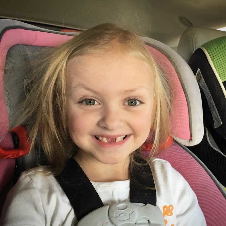 Ένα αγòρι μου είπε να μην φοράω μπλουζάκια που δείχνουν τις ουλές μου από καρκίνο γιατί τρομάζει - Το συγκινητικό γράμμα μητέρας