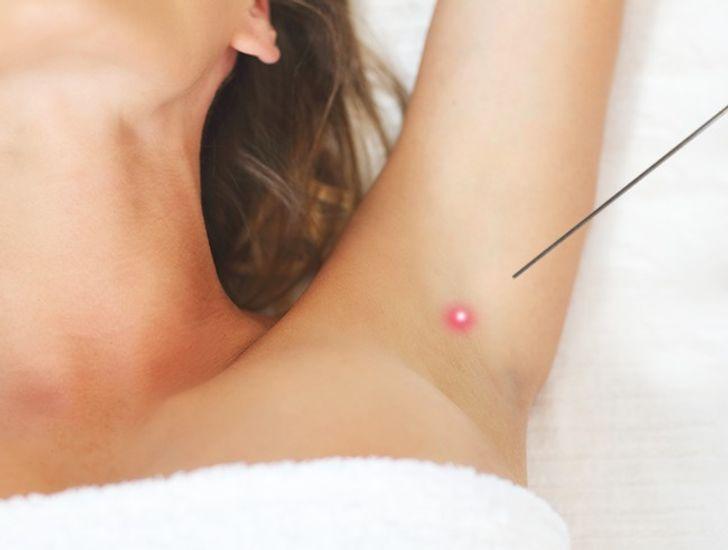 λύσεις_αν_ιδρώνεις_υπερβολικά_ λύσεις_αν_ιδρώνεις_υπερβολικά_