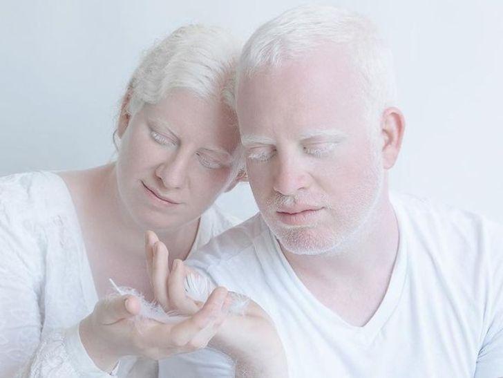 συγκλονιστικές φωτογραφίες_με_ανθρώπους_με_αλμπινισμό_