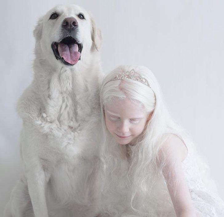 συγκλονιστικές φωτογραφίες_με_ανθρώπους_με_αλμπινισμό_