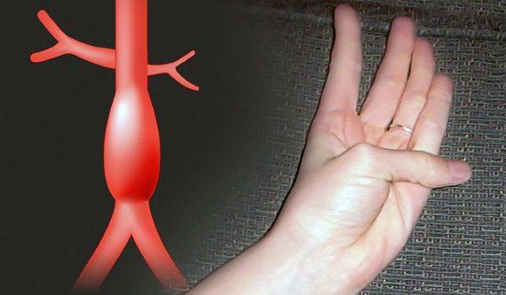 Το τεστ του αντίχειρα δείχνει ένα σοβαρό πρόβλημα υγείας