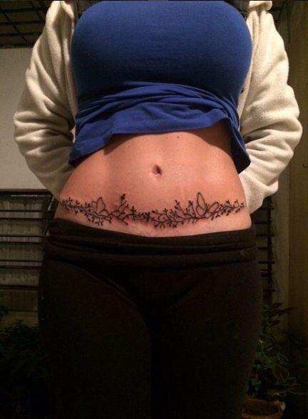 τατουάζ_με_λουλούδια_για_να_κρύψεις_το_σημάδι της καισαρικής_ τατουάζ_με_λουλούδια_για_να_κρύψεις_το_σημάδι της καισαρικής_