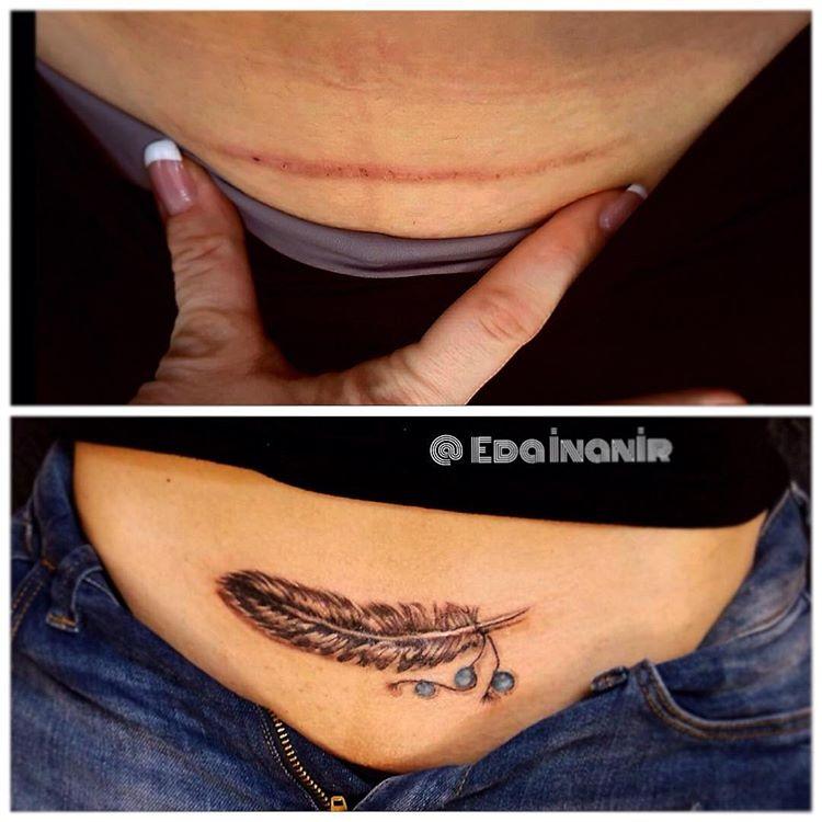 τατουάζ_με_φτερό_στο_σημάδι_της_καισαρικής_ τατουάζ_με_φτερό_στο_σημάδι_της_καισαρικής_