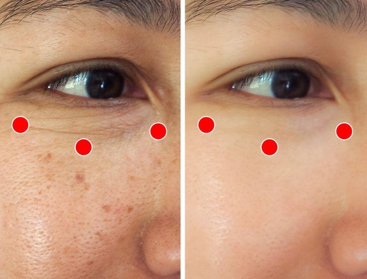 ιαπωνική_άσκηση_μασάζ Σιάτσου_για_να_εξαφανίσετε_τις_ρυτίδες_στα_μάτια_ ιαπωνική_άσκηση_μασάζ Σιάτσου_για_να_εξαφανίσετε_τις_ρυτίδες_στα_μάτια_