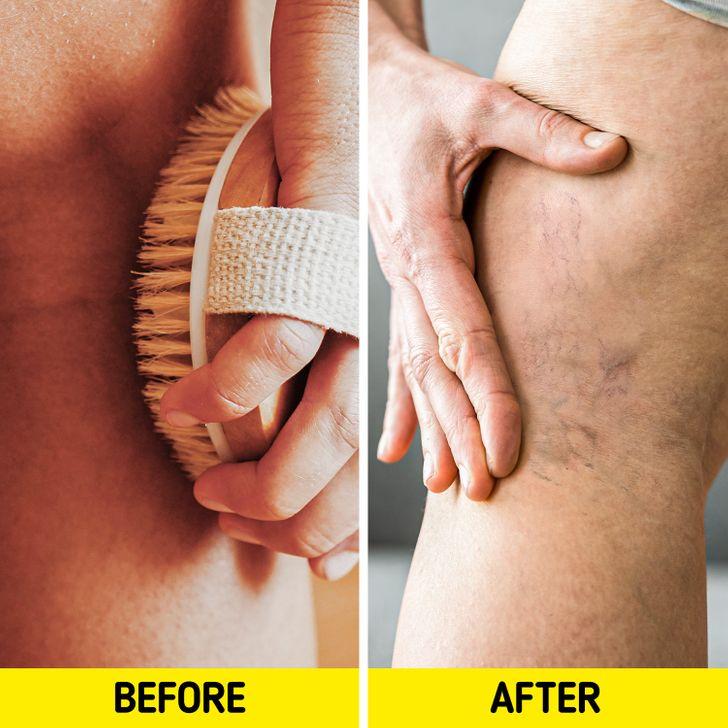 7_συνήθειες_που_βλάπτουν_τις_φλέβες_μας_ 7_συνήθειες_που_βλάπτουν_τις_φλέβες_μας_