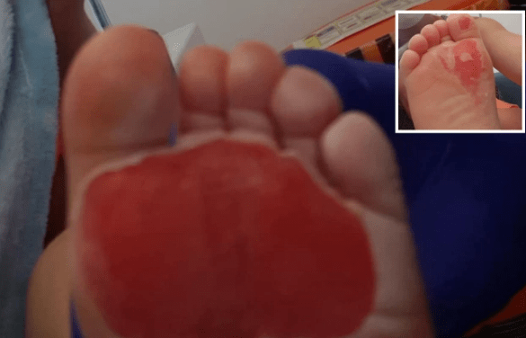 κίνδυνος_για_τα_παιδιά_το_Καλοκαίρι_