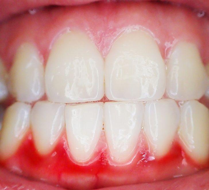 άγνωστα_συμπτώματα εγκυμοσύνης_