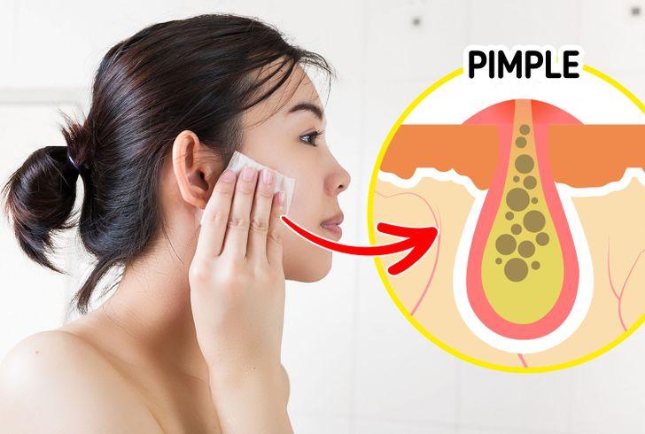 10_καθημερινές συνήθειες_που_καταστρέφουν_την_επιδερμίδα_