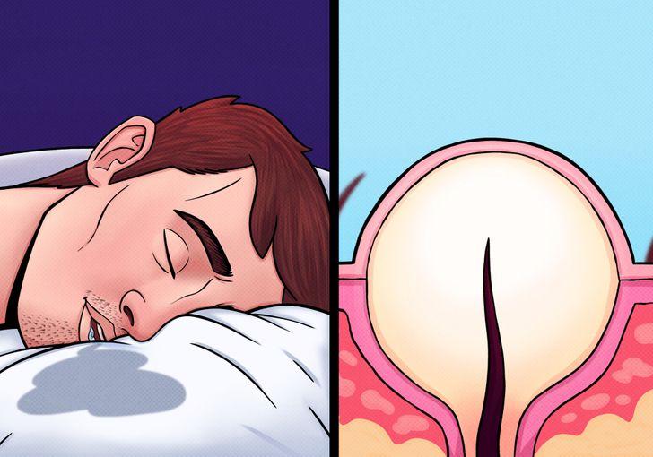 10_καθημερινές συνήθειες_που_καταστρέφουν_την_επιδερμίδα_