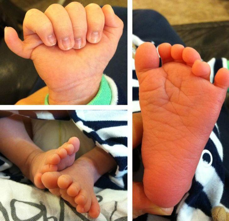 12_φωτογραφίες_που_προβάλλουν_την_διαφορετικότητα_