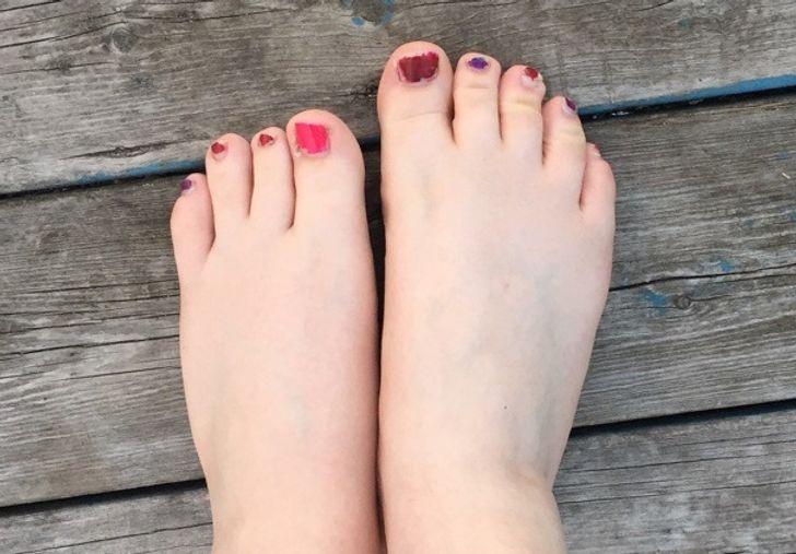 12_φωτογραφίες_που_προβάλλουν_την_διαφορετικότητα_