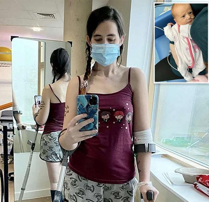 μαμά-προτίμησε-να-χάσει-το-πόδι-της-από-το-να-κάνει-έκτρωση-