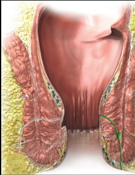 ΠΕΡΙΕΔΡΙΚΟ ΣΥΡΙΓΓΙΟ ΠΕΡΙΕΔΡΙΚΟ ΣΥΡΙΓΓΙΟ