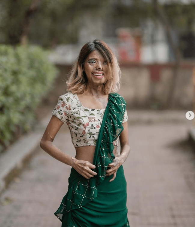 της-έριξε-οξύ-ο-πατέρας-της-και-πλέον-είναι-μοντέλο-ιστορία-