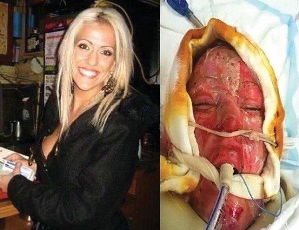 της-έβαλε-φωτιά-στο-πρόσωπο-και-βγάζει-την-μάσκα-ιστορία- της-έβαλε-φωτιά-στο-πρόσωπο-και-βγάζει-την-μάσκα-ιστορία-