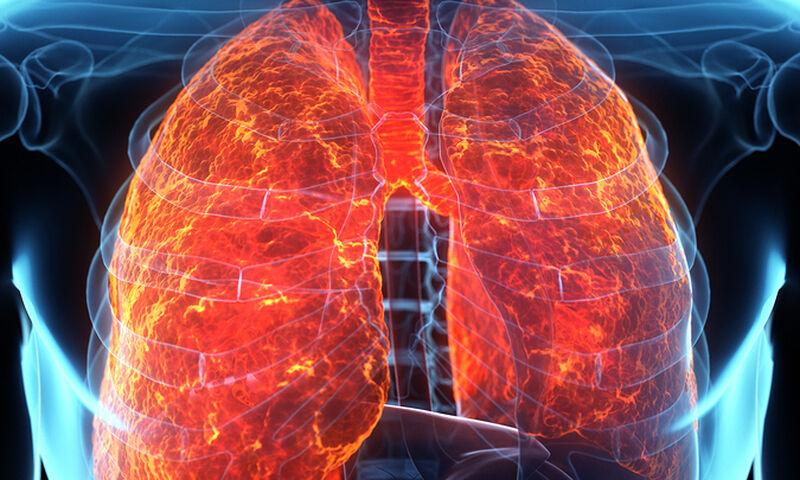 Υγρό στον πνεύμονα: Πότε η δυσκολία στην αναπνοή αποτελεί σύμπτωμα & πως επηρεάζει την καρδιά