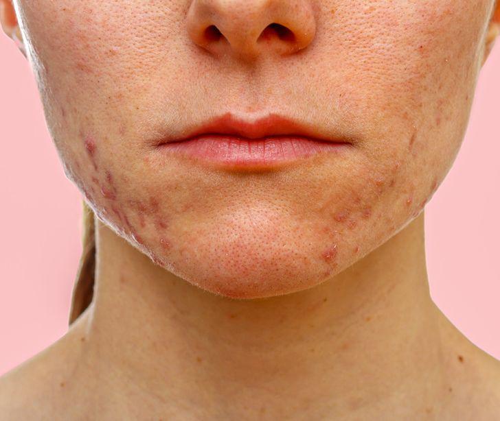 7-σημάδια-που-δείχνουν-ότι-τρώτε-πολύ-ψωμί- 7-σημάδια-που-δείχνουν-ότι-τρώτε-πολύ-ψωμί-