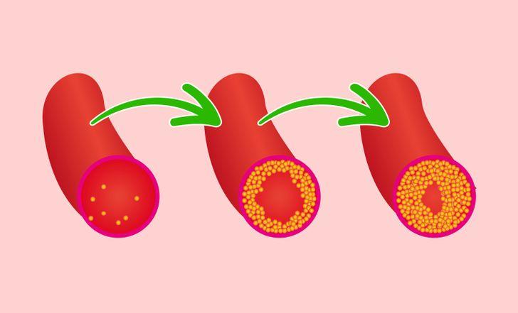 7-σημάδια-που-δείχνουν-ότι-τρώτε-πολύ-ψωμί- 7-σημάδια-που-δείχνουν-ότι-τρώτε-πολύ-ψωμί-