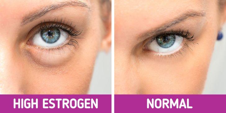 8-τρόποι-να-αντιμετωπίσετε-το-πρησμένο πρόσωπο- 8-τρόποι-να-αντιμετωπίσετε-το-πρησμένο πρόσωπο-